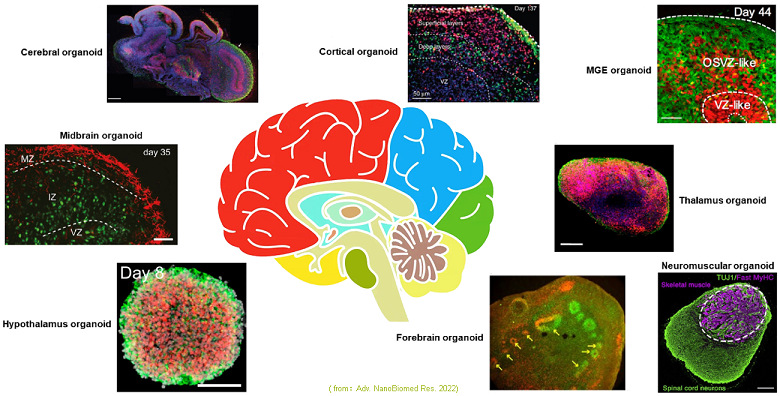 1750748272599862.jpg 圖4 已報(bào)導(dǎo)的腦類器官類型.jpg