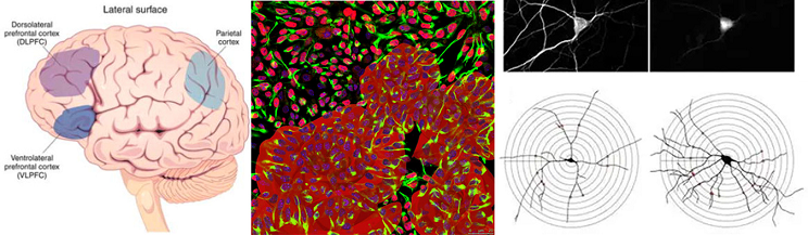腦皮質(zhì)類器官衍生過(guò)程中人誘導(dǎo)神經(jīng)細(xì)胞分化形成的玫瑰花結(jié).png 腦皮質(zhì)類器官衍生過(guò)程中人誘導(dǎo)神經(jīng)細(xì)胞分化形成的玫瑰花結(jié).png