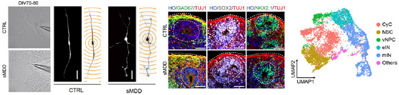 GABA能中間神經(jīng)元相關(guān)抑郁癥腦皮質(zhì)類器官的表征方法.jpg GABA能中間神經(jīng)元相關(guān)抑郁癥腦皮質(zhì)類器官的表征方法.jpg